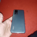 Redmi Note 11 | 8GB RAM | 64GB ROM | 5000mAh